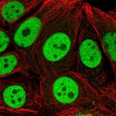 Immunocytochemistry/Immunofluorescence: CMP kinase Antibody [NBP2-33692] - Staining  of human cell line MCF-7 shows positivity in nucleus but excluded from the nucleoli.