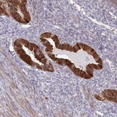 Immunohistochemistry: CMP kinase Antibody [NBP2-33692] - Staining of human uterus, post-menopause shows strong cytoplasmic positivity in glandular cells.