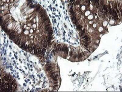 Immunohistochemistry: CMP kinase Antibody (OTI1A1) - Azide and BSA Free [NBP2-71947] - Analysis of Human colon tissue within the normal limits using CMPK1 mouse monoclonal antibody.