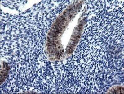 Immunohistochemistry: CMP kinase Antibody (OTI1A1) - Azide and BSA Free [NBP2-71947] - Analysis of Human endometrium tissue.