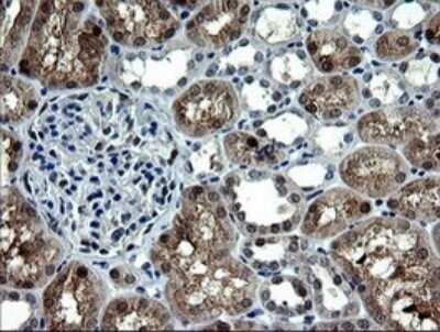 Immunohistochemistry: CMP kinase Antibody (OTI1A1) - Azide and BSA Free [NBP2-71947] - Analysis of Human Kidney tissue.