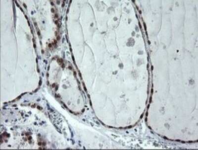 Immunohistochemistry: CMP kinase Antibody (OTI1A1) - Azide and BSA Free [NBP2-71947] - Analysis of Human thyroid tissue.