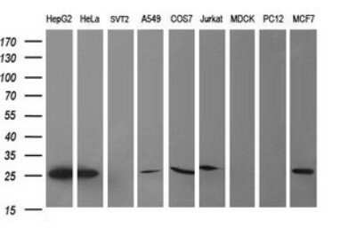 Western Blot: CMP kinase Antibody (OTI1A1) - Azide and BSA Free [NBP2-71947] - Analysis of extracts (35ug) from 9 different cell lines (HepG2: human; HeLa: human; SVT2: mouse; A549: human; COS7: monkey; Jurkat: human; MDCK: canine; PC12: rat; MCF7: human).