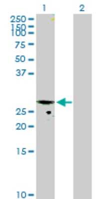 Western Blot: CMP kinase Antibody [H00051727-B01P] - Analysis of CMPK1 expression in transfected 293T cell line by CMPK1 polyclonal antibody.  Lane 1: CMPK transfected lysate(25.08 KDa). Lane 2: Non-transfected lysate.