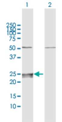 Western Blot: CMP kinase Antibody [H00051727-D01P] - Analysis of CMPK expression in transfected 293T cell line by CMPK polyclonal antibody.Lane 1: CMPK transfected lysate(26.00 KDa).Lane 2: Non-transfected lysate.