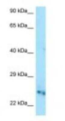 Western Blot: CMP kinase Antibody [NBP1-98367] - Mouse Heart lysate, concentration 1 ug/ml.