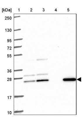 Western Blot: CMP kinase Antibody [NBP2-33692] - Lane 1: Marker  [kDa] 250, 130, 95, 72, 55, 36, 28, 17, 10.  Lane 2: Human cell line RT-4.  Lane 3: Human cell line U-251MG sp.  Lane 4: Human plasma (IgG/HSA depleted).  Lane 5: Human liver tissue