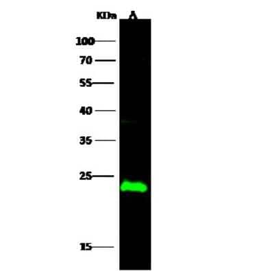 Western Blot: CMP kinase Antibody [NBP3-00262] - Anti-CMP kinase rabbit polyclonal antibody at 1:500 dilution. Lane A: HepG2 Whole Cell Lysate. Lysates/proteins at 30 ug per lane. Secondary Goat Anti-Rabbit IgG H&L (Dylight 800) at 1/10000 dilution. Developed using the Odyssey technique. Performed under reducing conditions. Predicted band size: 22 kDa. Observed band size: 23 kDa