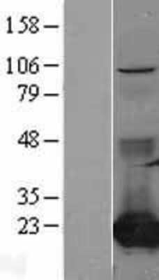 Western Blot: CMP kinase Overexpression Lysate (Adult Normal) [NBL1-09298] Left-Empty vector transfected control cell lysate (HEK293 cell lysate); Right -Over-expression Lysate for CMP kinase.