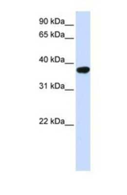 Western Blot: ICMT Antibody [NBP1-69579] - This Anti-ICMT antibody was used in Western Blot of Fetal Heart tissue lysate at a concentration of 1ug/ml.