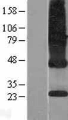 Western Blot ICMT Overexpression Lysate