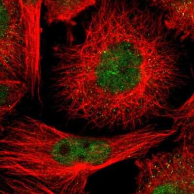 Immunocytochemistry/ Immunofluorescence CMTM1 Antibody - BSA Free