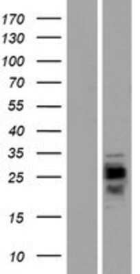 Western Blot: CMTM1 Overexpression Lysate (Adult Normal) [NBP2-04937] Left-Empty vector transfected control cell lysate (HEK293 cell lysate); Right -Over-expression Lysate for CMTM1.