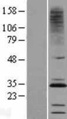 Western Blot CMTM2 Overexpression Lysate