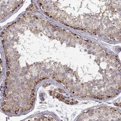 Immunohistochemistry-Paraffin CMTM3 Antibody - BSA Free