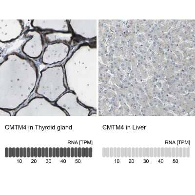 Immunohistochemistry-Paraffin CMTM4 Antibody - BSA Free