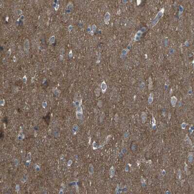 Immunohistochemistry-Paraffin CMTM4 Antibody - BSA Free