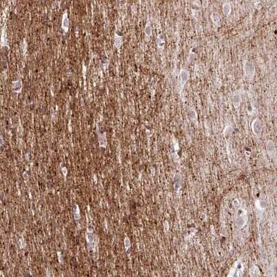 Immunohistochemistry: CMTM5 Antibody [NBP2-47503] - Staining of human cerebral cortex shows neuropil positivity.