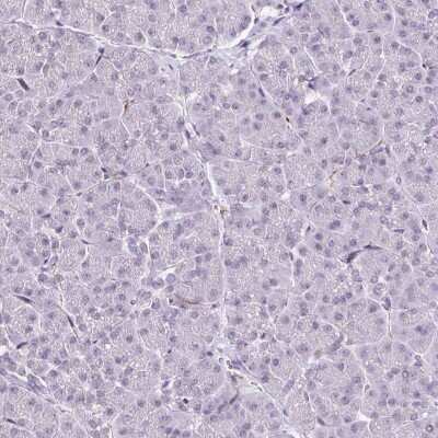 Immunohistochemistry-Paraffin CMTM5 Antibody - BSA Free