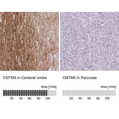 Immunohistochemistry-Paraffin CMTM5 Antibody - BSA Free