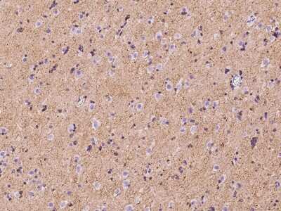Immunohistochemistry-Paraffin: CMTM5 Antibody [NBP2-97355] - Immunochemical staining of human CMTM5 in human brain with rabbit polyclonal antibody at 1:100 dilution, formalin-fixed paraffin embedded sections.