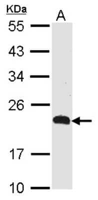 Western Blot: CMTM5 Antibody [NBP1-31149] - Sample (30 ug of whole cell lysate) A: Raji 12% SDS PAGE CKLFSF5 antibody diluted at 1:500.