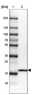 Western Blot CMTM5 Antibody - BSA Free