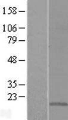 Western Blot: CMTM5 Overexpression Lysate (Adult Normal) [NBL1-09302] Left-Empty vector transfected control cell lysate (HEK293 cell lysate); Right -Over-expression Lysate for CMTM5.