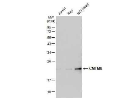 CMTM6 Antibody (NBP1-31183): Novus Biologicals