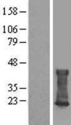 Western Blot: CMTM6 Overexpression Lysate (Adult Normal) [NBL1-09303] Left-Empty vector transfected control cell lysate (HEK293 cell lysate); Right -Over-expression Lysate for CMTM6.
