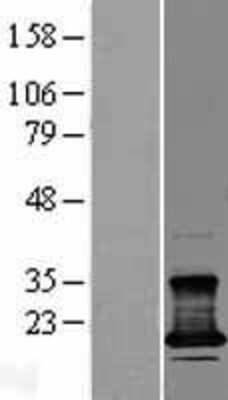 Western Blot CMTM7 Overexpression Lysate
