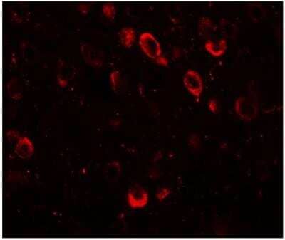 Immunohistochemistry: CMYA5 Antibody [NBP1-77117] - SPRYD2 in mouse brain tissue with SPRYD2 antibody at 20 ug/mL.