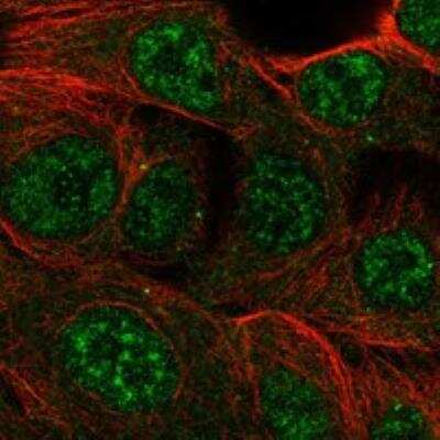 Immunocytochemistry/Immunofluorescence: CMYA5 Antibody [NBP3-17135] - Staining of human cell line MCF7 shows localization to nuclear speckles & cytosol.S