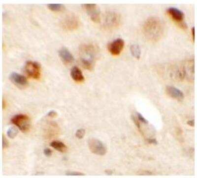 Immunohistochemistry: CMYA5 Antibody [NBP1-77117] - SPRYD2 in mouse brain tissue with SPRYD2 antibody at 2.5 ug/mL.