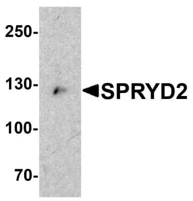 Western Blot: CMYA5 Antibody [NBP1-77117] - Analysis in mouse heart tissue lysate with antibody at 1 ug/mL.