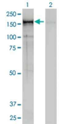 Western Blot: CNAP1 Antibody (4C12) [H00009918-M01] - Analysis of CNAP1 expression in transfected 293T cell line by CNAP1 monoclonal antibody (M01), clone 4C12.Lane 1: CNAP1 transfected lysate(157 KDa).Lane 2: Non-transfected lysate.