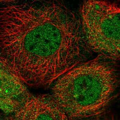 Immunocytochemistry/Immunofluorescence: CNAP1 Antibody [NBP1-88202] - Immunofluorescent staining of human cell line A-431 shows localization to nucleoplasm & cytosol.