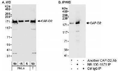 Western Blot: CNAP1 Antibody [NB100-1570] - Detection of Human CAP-D2 on HeLa whole cell lysate using NB100-1570.