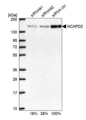 Western Blot: CNAP1 Antibody [NBP1-88201] - Analysis in U2OS cells transfected with control siRNA, target specific siRNA probe #1 and #2. Remaining relative intensity is presented.