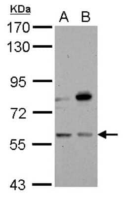 Western Blot: CNDP1 Antibody [NBP2-15925] - Sample (30 ug of whole cell lysate) A: 293T B: A431 7. 5% SDS PAGE gel, diluted at 1:1000.