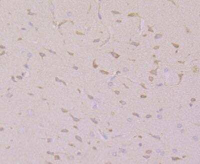 Immunohistochemistry: CNGA2 Antibody [NBP2-76924] - Immunohistochemical analysis of paraffin-embedded rat brain tissue using anti-CNGA2 antibody. Counter stained with hematoxylin.