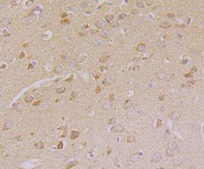 Immunohistochemistry: CNGA2 Antibody [NBP2-76924] - Immunohistochemical analysis of paraffin-embedded mouse brain tissue using anti-CNGA2 antibody. Counter stained with hematoxylin.