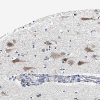 Immunohistochemistry-Paraffin CNGA2 Antibody