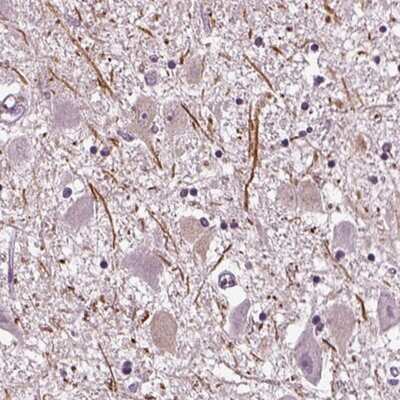 Immunohistochemistry-Paraffin: CNGA3 Antibody [NBP2-68684] - Staining of human hypothalamus shows strong positivity in neuronal projections.