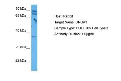 Western Blot: CNGA3 Antibody [NBP2-84701] - Host: Rabbit. Target Name: CNGA3. Sample Tissue: Human COLO205 Whole Cell lysates. Antibody Dilution: 1ug/ml