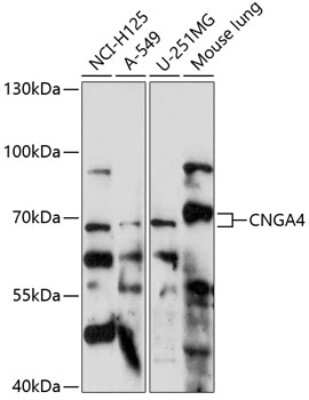 Western Blot: CNGA4 Antibody [NBP2-92183] - Analysis of extracts of various cell lines, using CNGA4 .Exposure time: 90s.