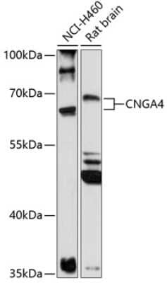 Western Blot: CNGA4 Antibody [NBP2-92184] - Analysis of extracts of various cell lines, using CNGA4 at 1:1000 dilution.Secondary antibody: HRP Goat Anti-Rabbit IgG (H+L) at 1:10000 dilution.Lysates/proteins: 25ug per lane.Blocking buffer: 3% nonfat dry milk in TBST.Detection: ECL Basic Kit .Exposure time: 90s.