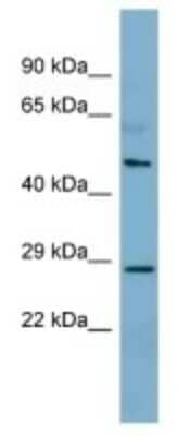 Western Blot: CNGA4 Antibody [NBP3-10583] - Western blot analysis of CNGA4 in Fetal Thymus lysates. Antibody dilution at 1.0ug/ml