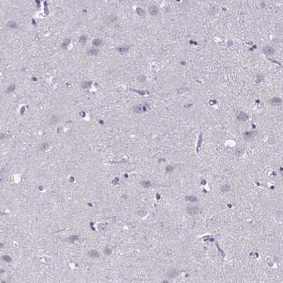 Immunohistochemistry-Paraffin: CNGB3 Antibody [NBP2-58445] - Staining of human cerebral cortex shows no positivity in neurons as expected.