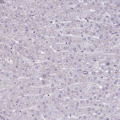 Immunohistochemistry-Paraffin: CNGB3 Antibody [NBP2-58445] - Staining of human liver shows no positivity in hepatocytes as expected.